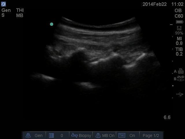 Ultrasound-Guidance