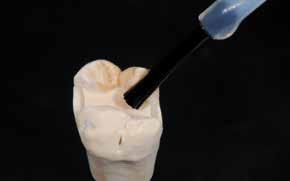 Practical Procedure Framework-free restorations (inlay/onlay) Model isolation Sealer application Fabricate a master model or a model with detachable segments according to the impression in the usual