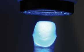 Next, complete the restoration step by step using Incisal and Transpa materials. Build up the palatal ridges using Dentin materials.