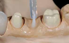 Cervical, dentin and incisal layering Sealing the model Isolate all areas of the model which come into contact with SR Nexco prior to the dentin and incisal layering.