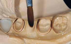 Dentin/incisal layering Sealing the model Isolate all areas of the model which come into contact with SR Nexco prior to the dentin and
