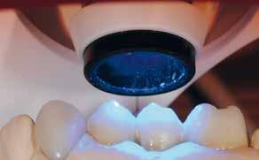 Dentin/incisal layering The layering procedure of the individual SR Nexco Paste materials is carried out either in accordance with the
