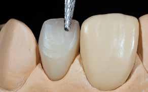 Practical Procedure Modification and characterization of denture teeth Denture teeth can be