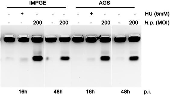 pylori P12 or an isogenic ΔvacAΔγgt double mutant for 6 h at the indicated MOIs. DNA integrity was assessed by PFGE.