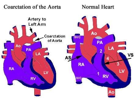 aorta 2.
