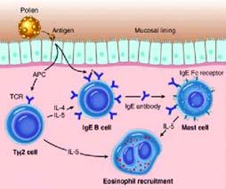 Asthma, Sensitization Sensitization of CD4 cells The