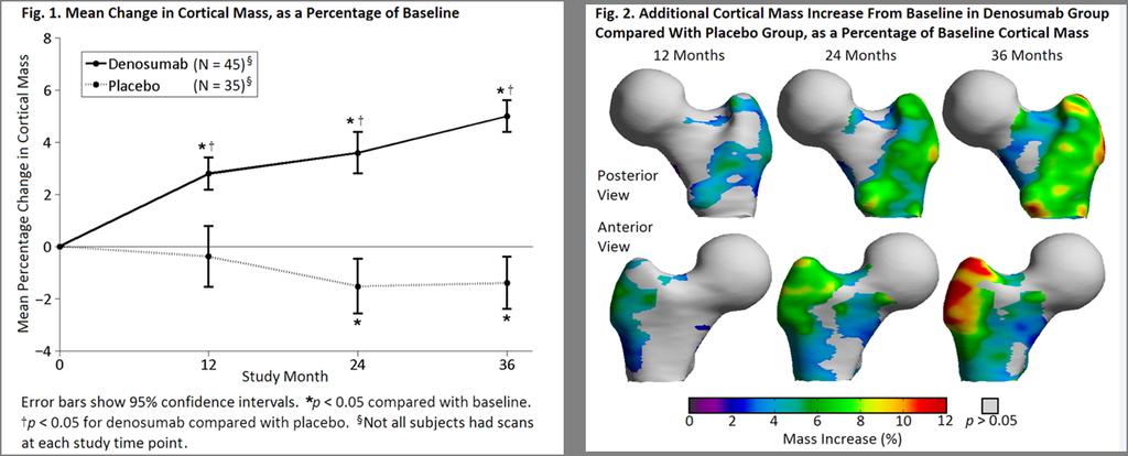 103 - Denosumab Treatment Is Associated With Progressive Improvements in Cortical Mass and Thickness at the Hip in Regions Relevant to Fracture Protection Kenneth Poole 1, Graham Treece 1, Andrew Gee