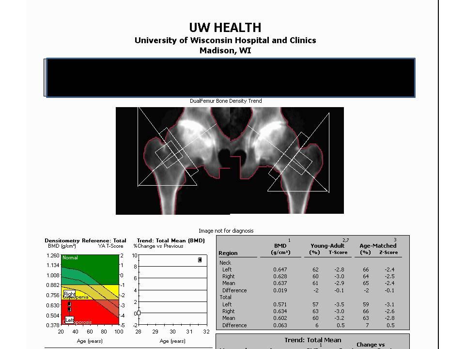 121 - Adding VFA to DXA Changes Clinical Classification and Improves Detection of Fracture Risk Jay Ginther and Dixie Burk; Cedar Valley Medical Specialists, PC, Waterloo, IA BACKGROUND: Patients
