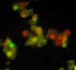 Viable cells sel apoptosis Apoptotic (mati)