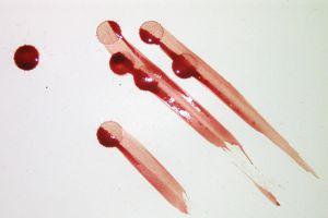 -a non-blood bearing object moves through a wet bloodstain, altering the appearance of the original stain d.