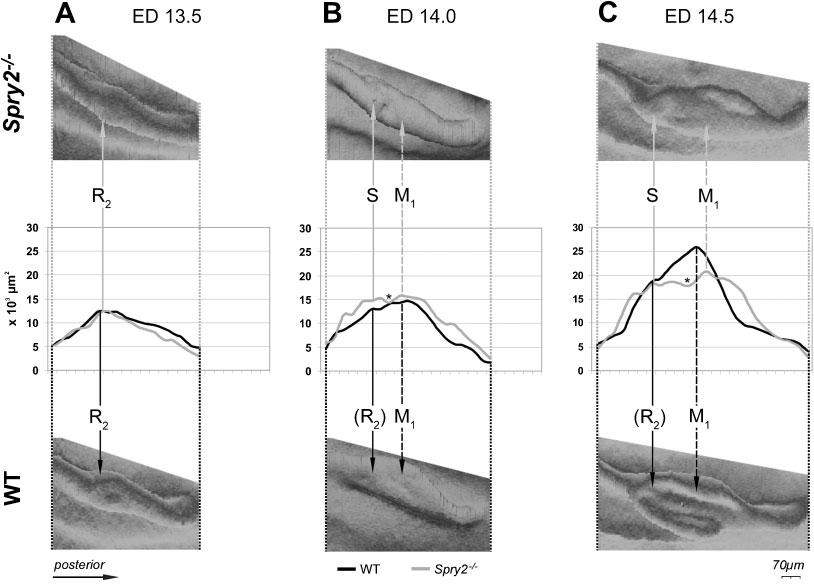 298 R. PETERKOVA ET AL. Fig. 5. Changes in size of the dental epithelium along the antero-posterior axis.