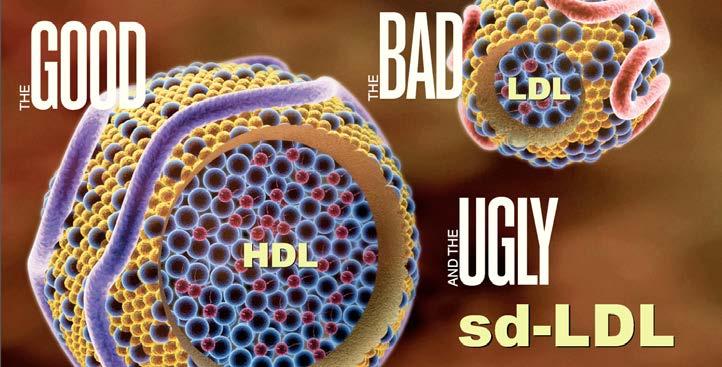 dense LDLs (sd-ldl) are more