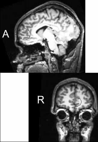 Neuroimaging Response MRI s show increase activity in the Medial pre-frontal cortex (mpfc) when people think about others or themselves 10 Princeton University Undergraduates