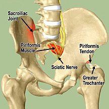 *Note: The iliotibial band syndrome symptoms which the client was experiencing were caused by a spasmed piriformis in conjunction with an overly tightened gluteus medius which was exerting pressure
