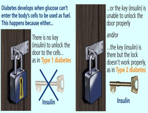 Diabetes Diabetes is a chronic disease that occurs when the pancreas does not produce any/enough insulin or when the body cannot use the insulin that it produces (WHO) There are 2 primary forms of