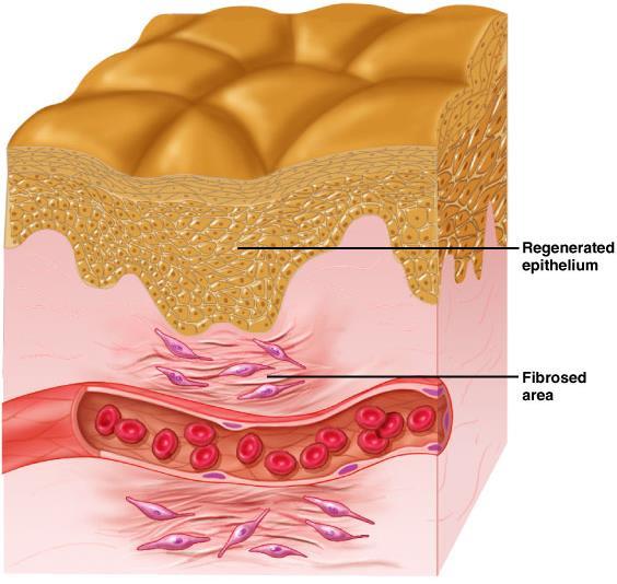 Tissue Repair Results in a fully