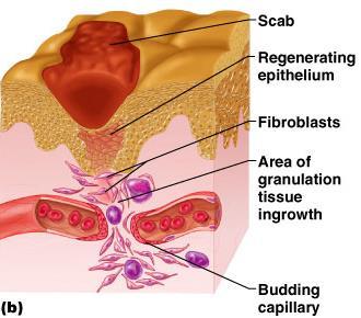 Tissue Repair Fibrous tissue matures