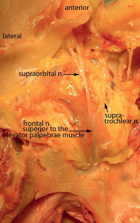The most superior structures are visible. The lacrimal gland is located in the superior lateral part of the orbit.