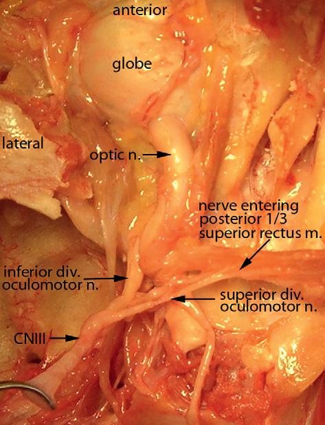 All the nerve fibers from these various topographically organized nuclei join together within the brainstem, and after running through the red nucleus and cerebral peduncle, exit the brainstem on its