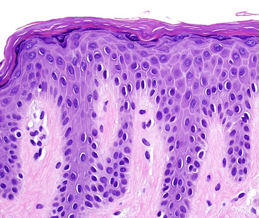 Can you name the four major layers of the epidermis?