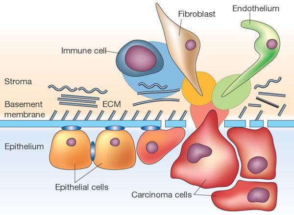 Complex cancer microenvironment Major factor that affect the