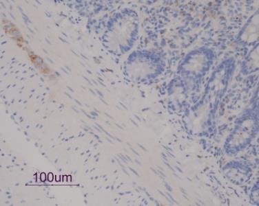 Representative D2R immunohistochemical findings on isolated