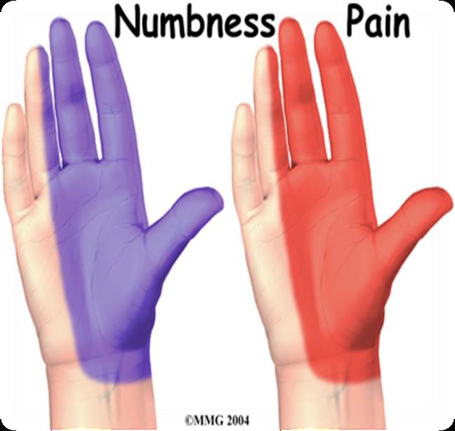 Early symptoms usually relieved by stopping the aggravating movement and by placing hand and wrist at rest by