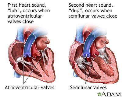 15 The Cardiovascular and peripheral Vascular Systems Heart: The first heart sound, S1, occurs when the atrioventricular valves close. Producing a dull, lowpitched sound described as lub.