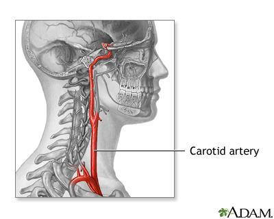 18 The Cardiovascular and peripheral Vascular Systems Central Vessels: The carotid arteries supply