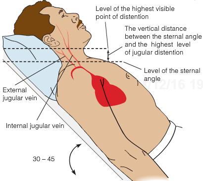 The internal jugular veins lie deeper along the carotid artery and may transmit pulsations onto the skin of the neck.