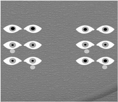 Pinhole (PH) Must be reproducible Visual fields Pupils Measures peripheral vision One eye at a time 1,2,or 5 fingers in each quadrant while patient fixates on nose Notation: Visual fields full to