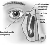 Surgery Cornea Eyelids Conjunctiva Blepharitis Dry eye syndrome Stye / Chalazion
