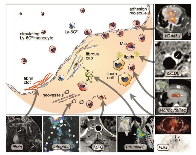 Molecular Imaging Targets in Atherosclerosis