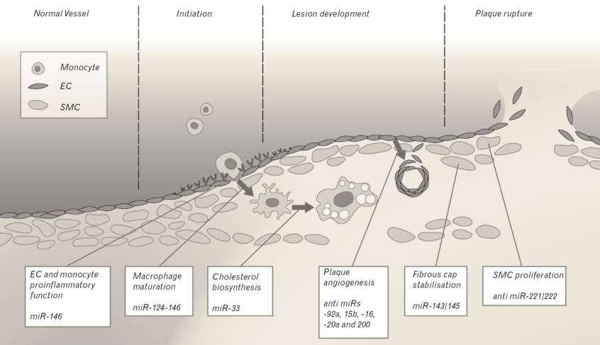 Therapeutic Modification of Atherosclerosis by
