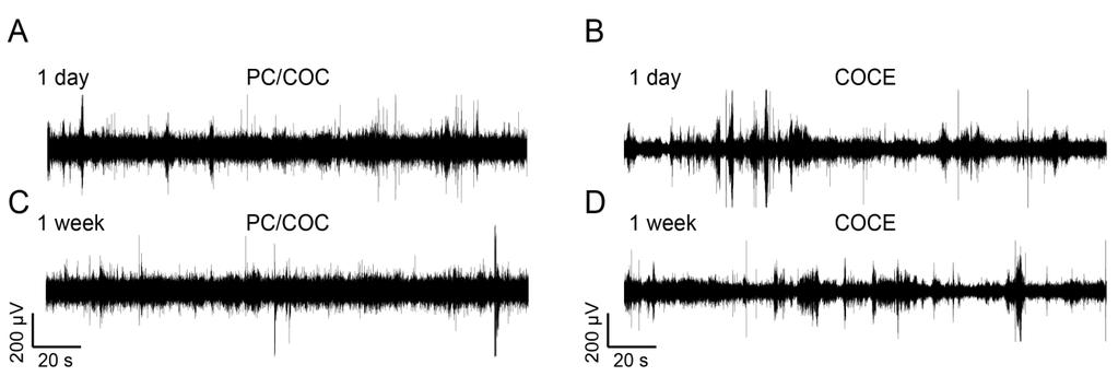 fig. S6. Electrophysiological recording collected from the freely moving mice implanted with fiber probes.