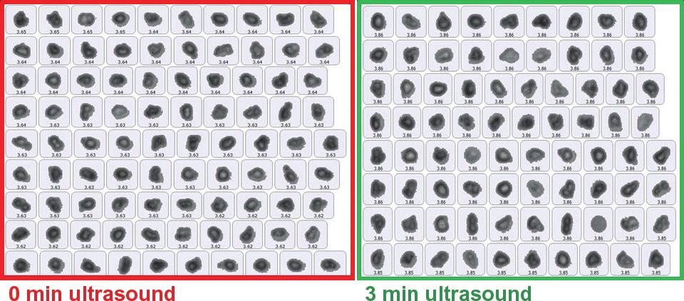 and the number of particles that can be characterised in a single experiment make automated imaging a practical alternative to manual microscopy.
