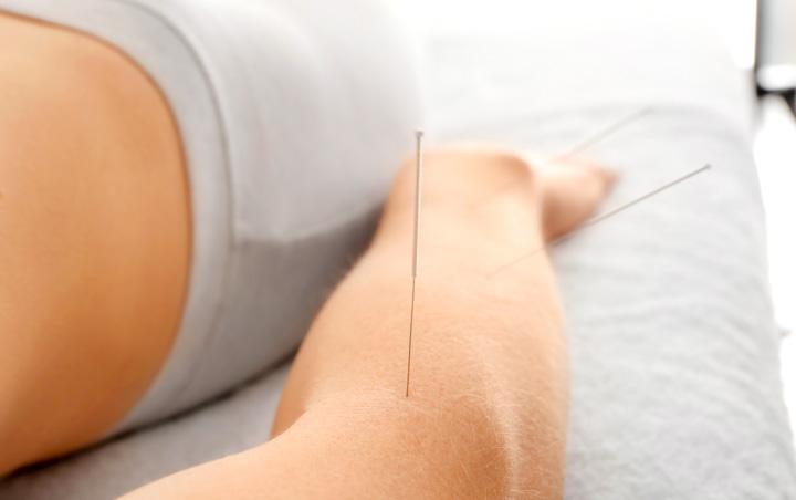Acupuncture Reduces Pain, Alleviates Depression 25 APRIL 2017 Memorial Sloan Kettering Cancer Center (New York, USA) and University of York (York, UK) researchers conclude that acupuncture is more