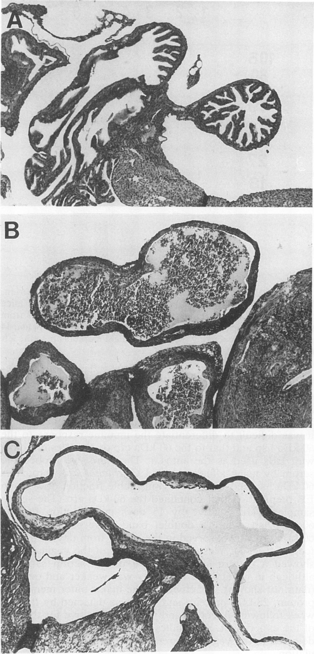 VOL. 61, 1993 TABLE 1. Culture and immunological results for mice infected with the C.