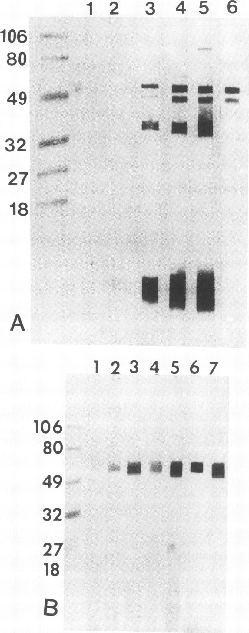 774 NOTES 80 * 32# 12 3 4 5 6 7 au a a as. WA Nspq 1 FIG. 2. Western blot analysis of the total Ig response in serum.