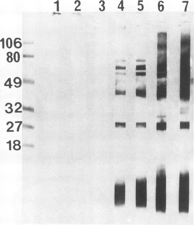 Lanes 1 to 7, serum samples from the infected groups corresponding to days 0, 5, 13, 15, 24, 38, and 44 postinfection, respectively. Molecular weight markers are in the left lane of the blot.