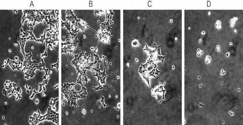 Fig. 1 Phase-contrast photomicrographs (x200) of PC12m3 cells were taken seven days after treatment of electrical stimulation in the presence of NGF (30 ng/ml).
