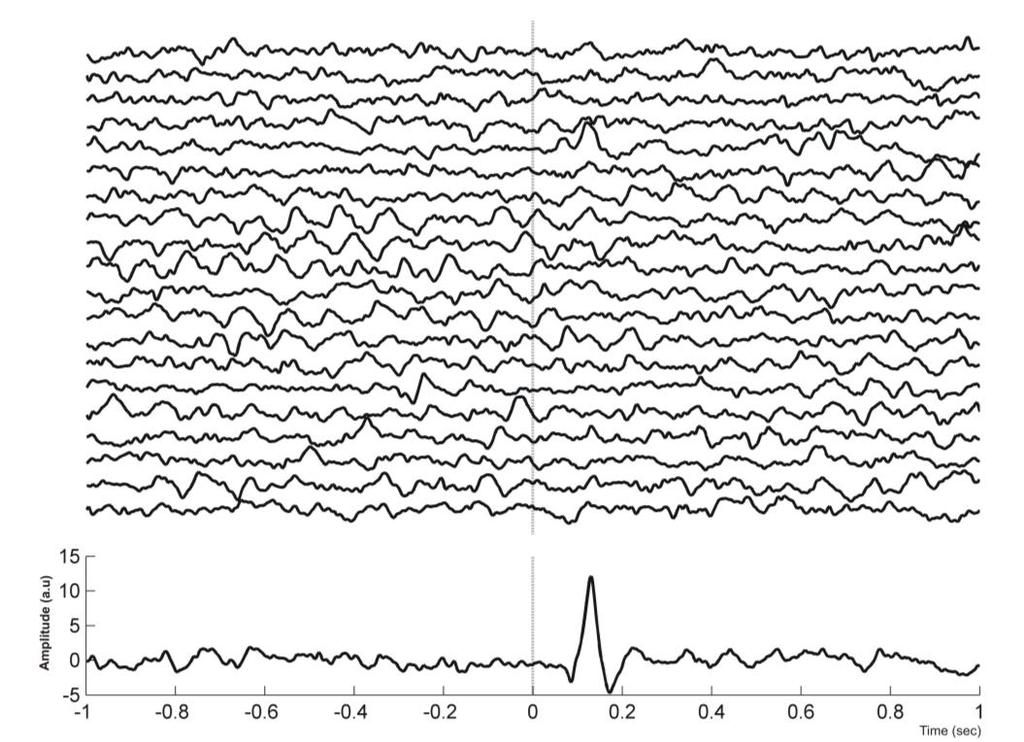 Figure 1.4 Single-trials ERPs. 20 trials of ERPs recorded on the left occipital location (up) and the average ERP (bottom). The vertical line indicates the onset time of the stimulus presentation.