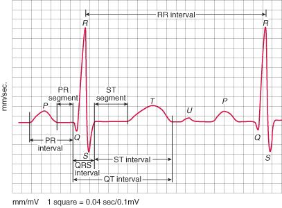 PR interval: QRS complex: QT interval: Measures fro the beginning of the P wave to the beginning of the Q wave Normal: 0.12-0.