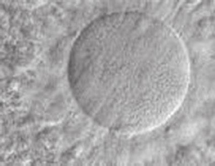 3 Various stages of oocyte maturation: a immature oocyte in prophase I of meiosis I; b metaphase I oocyte; c cumulus:oocyte complex exhibiting morphology typically associated with mature oocytes at