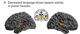 Cognitive Decline & Dementia Auditory Perceptual Processing Requirements Available Cognitive Resources For Performance of