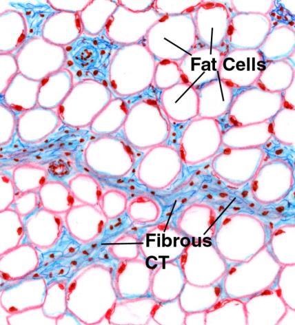 Adipose Tissue (AT) Adipose tissue, being the morphological dimension, can be defined anatomically as the paniculus adiposus