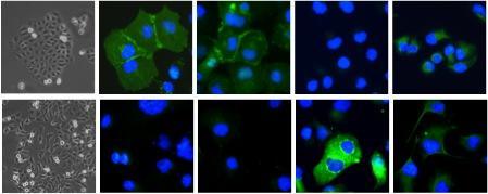 Number of cells Potential Targets: Brachyury Embryologic Transcription Factor: Over-expression Induces EMT in Epithelial Tumor Cells E-cadherin Epithelial Plakoglobin Mesenchymal Fibronectin