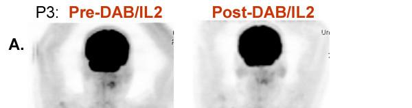 Anti-PD-1 mab phase I (MDX-1106; BMS 93655): Tumor response 60.