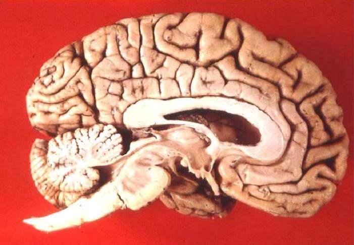 Neuroanatomy: Brain and Ventricular System 4 th Ventricle Gyrus Sulcus Lateral Ventricles 3 rd
