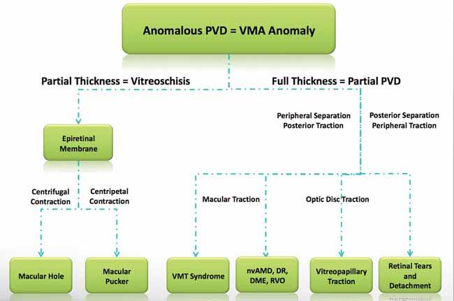 DIAGNOSIS, PATHOLOGIC IMPLICATIONS, AND MANAGEMENT Figure 1. The implications of anomalous PVD. tion occurs with peripheral separation, macular traction may result.